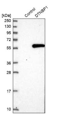 Western Blot: Dysbindin Antibody [NBP1-85300]