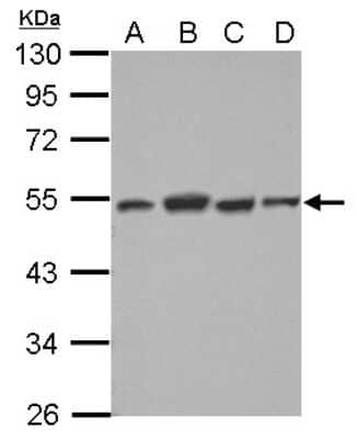 Western Blot: Dysbindin Antibody [NBP2-16245]