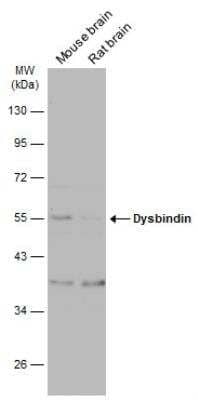 Western Blot: Dysbindin Antibody [NBP2-16245]