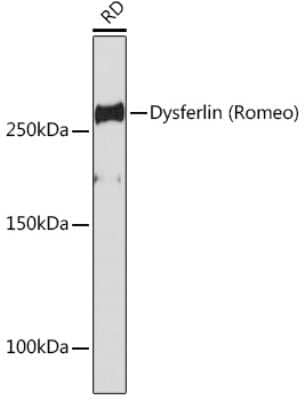 Western Blot: Dysferlin Antibody (3U1P9) [NBP3-15781]