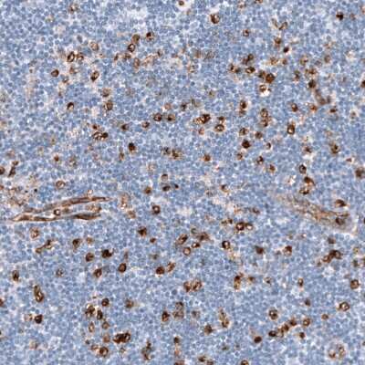 Immunohistochemistry-Paraffin: Dysferlin Antibody (CL10888) [NBP3-07994]