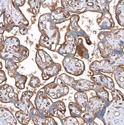 Immunohistochemistry-Paraffin: Dysferlin Antibody (CL10888) [NBP3-07994]