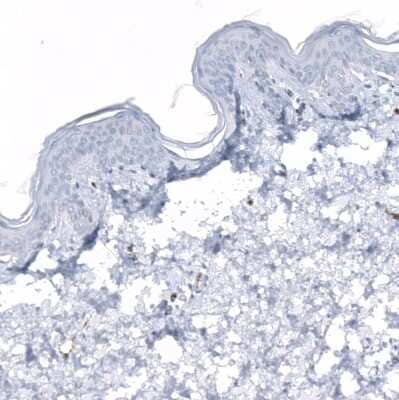 Immunohistochemistry-Paraffin: Dysferlin Antibody (CL10888) [NBP3-07994]