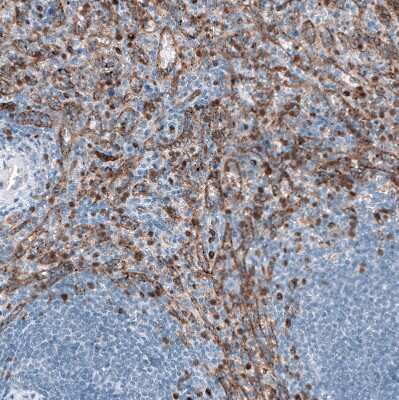 Immunohistochemistry-Paraffin: Dysferlin Antibody (CL10888) [NBP3-07994]