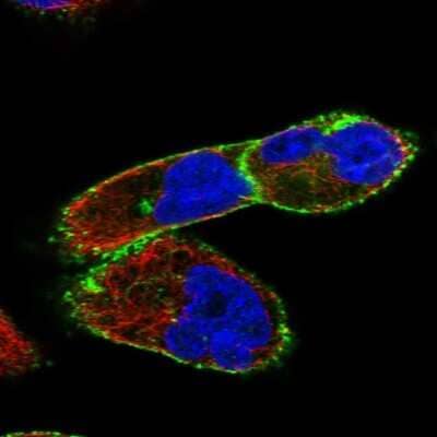 Immunocytochemistry/ Immunofluorescence: Dysferlin Antibody [NBP1-84696]