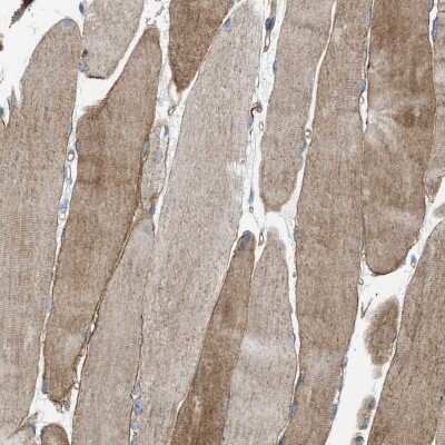 Immunohistochemistry-Paraffin: Dysferlin Antibody [NBP1-84695]