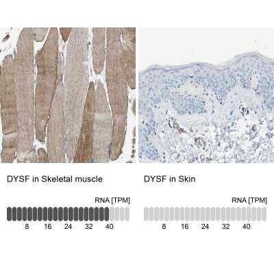 Immunohistochemistry-Paraffin: Dysferlin Antibody [NBP1-84695]