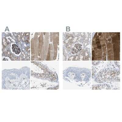Immunohistochemistry-Paraffin: Dysferlin Antibody [NBP1-84695]