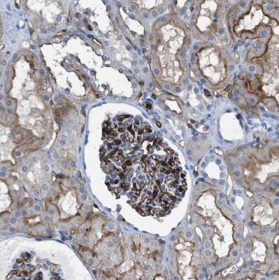 Immunohistochemistry-Paraffin: Dysferlin Antibody [NBP1-84695]