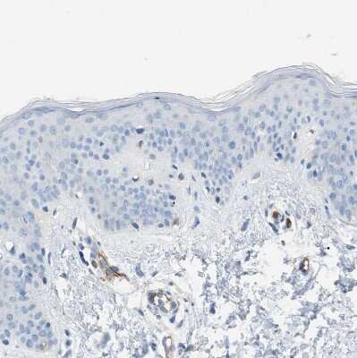 Immunohistochemistry-Paraffin: Dysferlin Antibody [NBP1-84695]