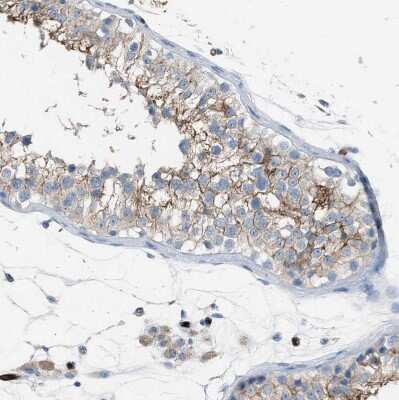 Immunohistochemistry-Paraffin: Dysferlin Antibody [NBP1-84695]