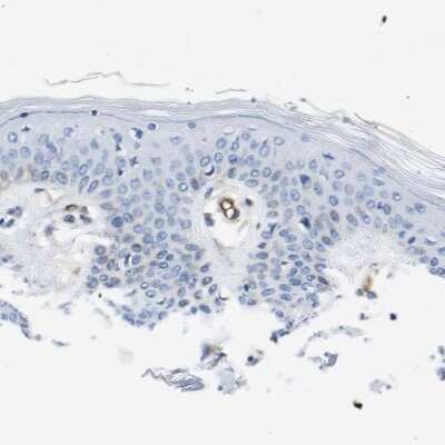 Immunohistochemistry-Paraffin: Dysferlin Antibody [NBP1-84696]