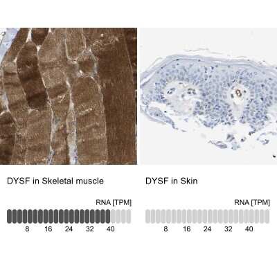 Immunohistochemistry-Paraffin: Dysferlin Antibody [NBP1-84696]