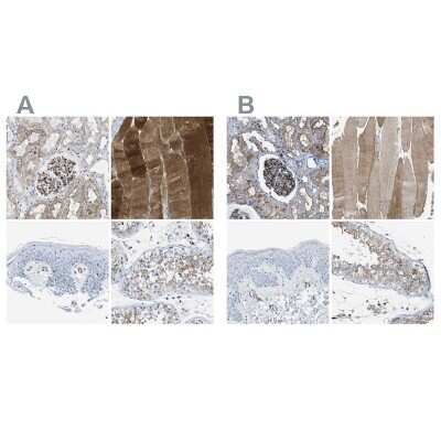 Immunohistochemistry-Paraffin: Dysferlin Antibody [NBP1-84696]