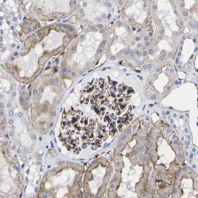 Immunohistochemistry-Paraffin: Dysferlin Antibody [NBP1-84696]