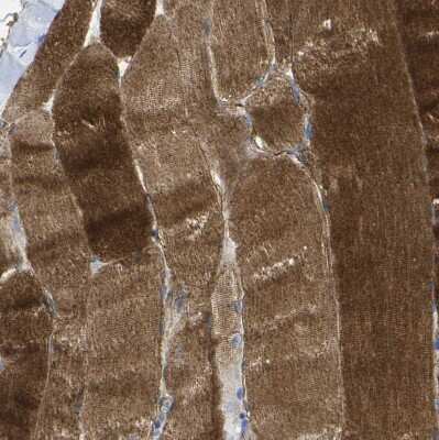 Immunohistochemistry-Paraffin: Dysferlin Antibody [NBP1-84696]