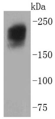 Western Blot: Dysferlin Antibody (JF05-54) [NBP2-66814]