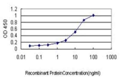 ELISA: Dystonin Antibody (1B10) [H00000667-M01]