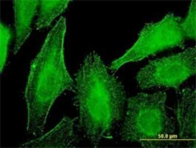 Immunocytochemistry/ Immunofluorescence: Dystonin Antibody (1B10) [H00000667-M01]