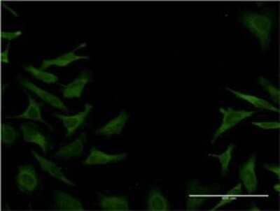 Immunocytochemistry/ Immunofluorescence: Dystonin Antibody (1D2) [H00000667-M02]