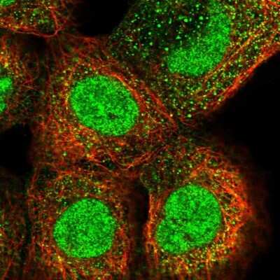 Immunocytochemistry/ Immunofluorescence: Dystonin Antibody [NBP1-89946]