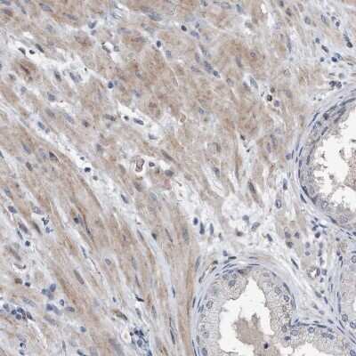 Immunohistochemistry-Paraffin: Dystonin Antibody [NBP1-89946]