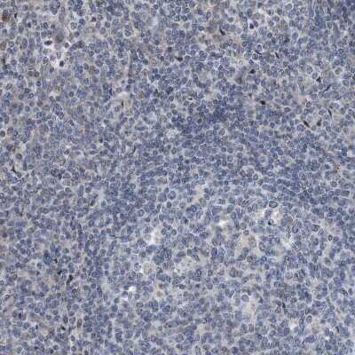 Immunohistochemistry-Paraffin: Dystonin Antibody [NBP1-89946]
