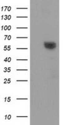 Western Blot: Dystrobrevin alpha Antibody (OTI1B2) [NBP2-03422]