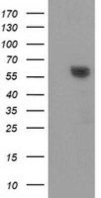 Western Blot: Dystrobrevin alpha Antibody (OTI1B2)Azide and BSA Free [NBP2-70591]