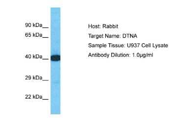 Western Blot: Dystrobrevin alpha Antibody [NBP2-88808]