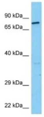 Western Blot: Dystrobrevin alpha Antibody [NBP3-10865]