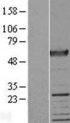 Western Blot: Dystrobrevin alpha Overexpression Lysate [NBP2-05939]