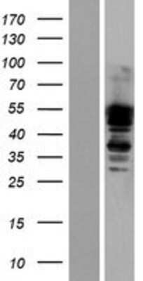 Western Blot: Dystrobrevin alpha Overexpression Lysate [NBP2-05940]