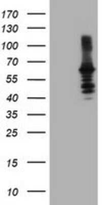 Western Blot: Dystrobrevin beta Antibody (OTI3A12) [NBP2-01798]