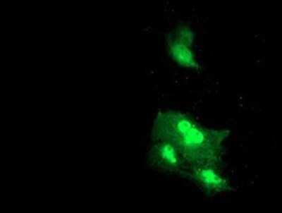 Immunocytochemistry/ Immunofluorescence: Dystrobrevin beta Antibody (OTI3A12) - Azide and BSA Free [NBP2-70598]