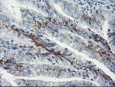 Immunohistochemistry: Dystrobrevin beta Antibody (OTI3A12) - Azide and BSA Free [NBP2-70598]