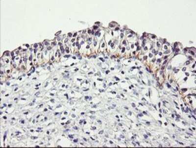 Immunohistochemistry: Dystrobrevin beta Antibody (OTI3A12) - Azide and BSA Free [NBP2-70598]