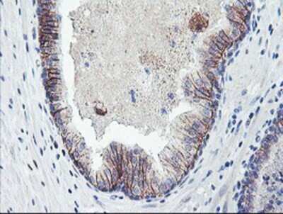 Immunohistochemistry: Dystrobrevin beta Antibody (OTI3A12) - Azide and BSA Free [NBP2-70598]
