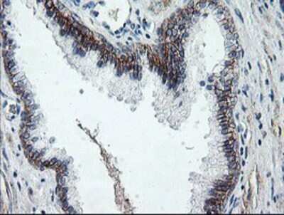 Immunohistochemistry: Dystrobrevin beta Antibody (OTI3A12) - Azide and BSA Free [NBP2-70598]