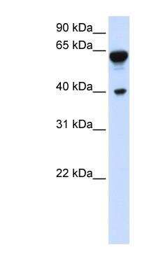 Western Blot: Dystrobrevin beta Antibody [NBP1-56492]