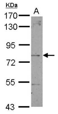 Western Blot: Dystrobrevin beta Antibody [NBP2-16246]