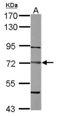 Western Blot: Dystrobrevin beta Antibody [NBP2-16247]