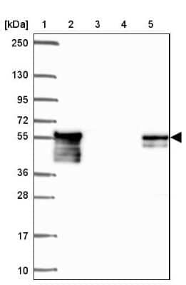 Western Blot: Dystrobrevin beta Antibody [NBP2-38915]