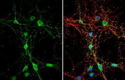 Immunocytochemistry/ Immunofluorescence: Dystroglycan Antibody [NBP2-14868]