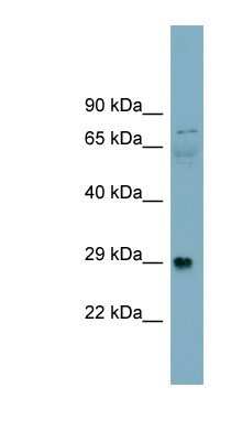 Western Blot: Alpha Dystroglycan Antibody [NBP1-59781]