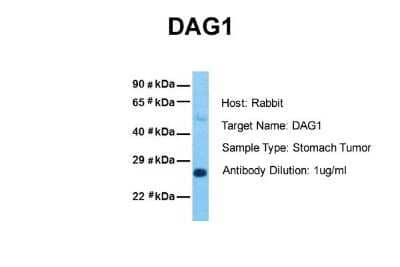 Western Blot: Alpha Dystroglycan Antibody [NBP1-59781]