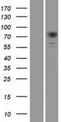 Western Blot: DMPK Overexpression Lysate [NBP2-10590]