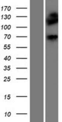 Western Blot: DMPK Overexpression Lysate [NBP2-10661]