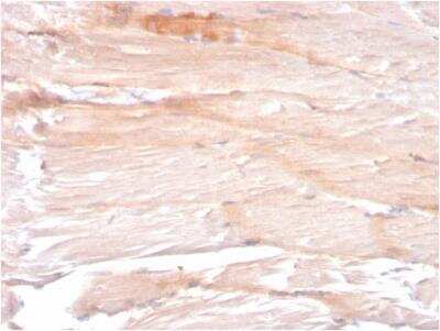 Immunohistochemistry-Paraffin: Dystrophin Antibody (DMD/3241) - Azide and BSA Free [NBP2-79910]