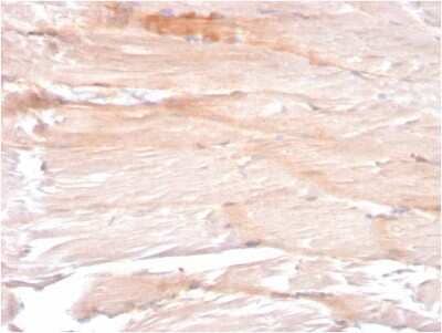 Immunohistochemistry-Paraffin: Dystrophin Antibody (DMD/3241) [NBP2-79776]